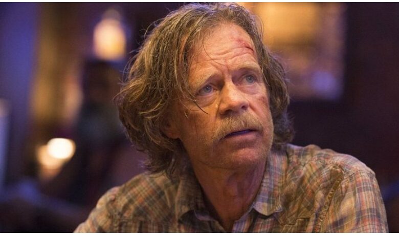 Shameless' Frank Gallagher faces a new health issue