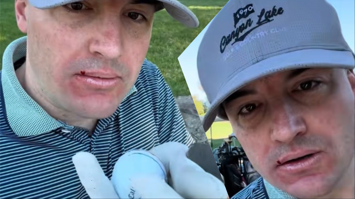 California Golf Injury