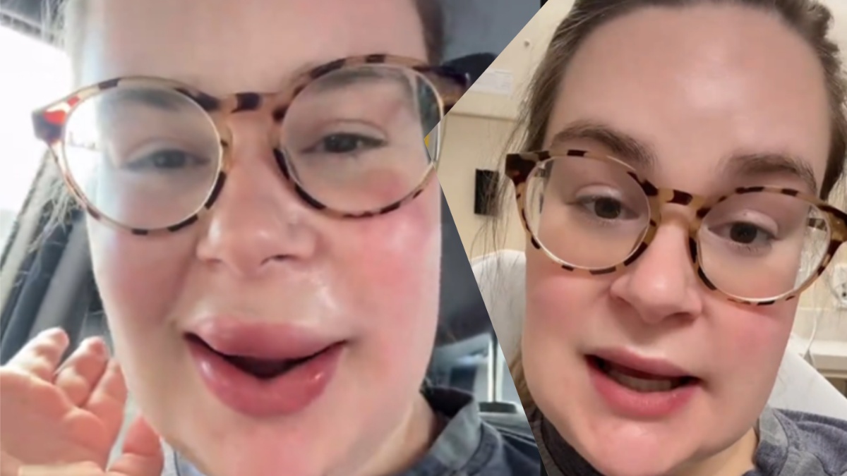 illinois woman wakes with swollen lips